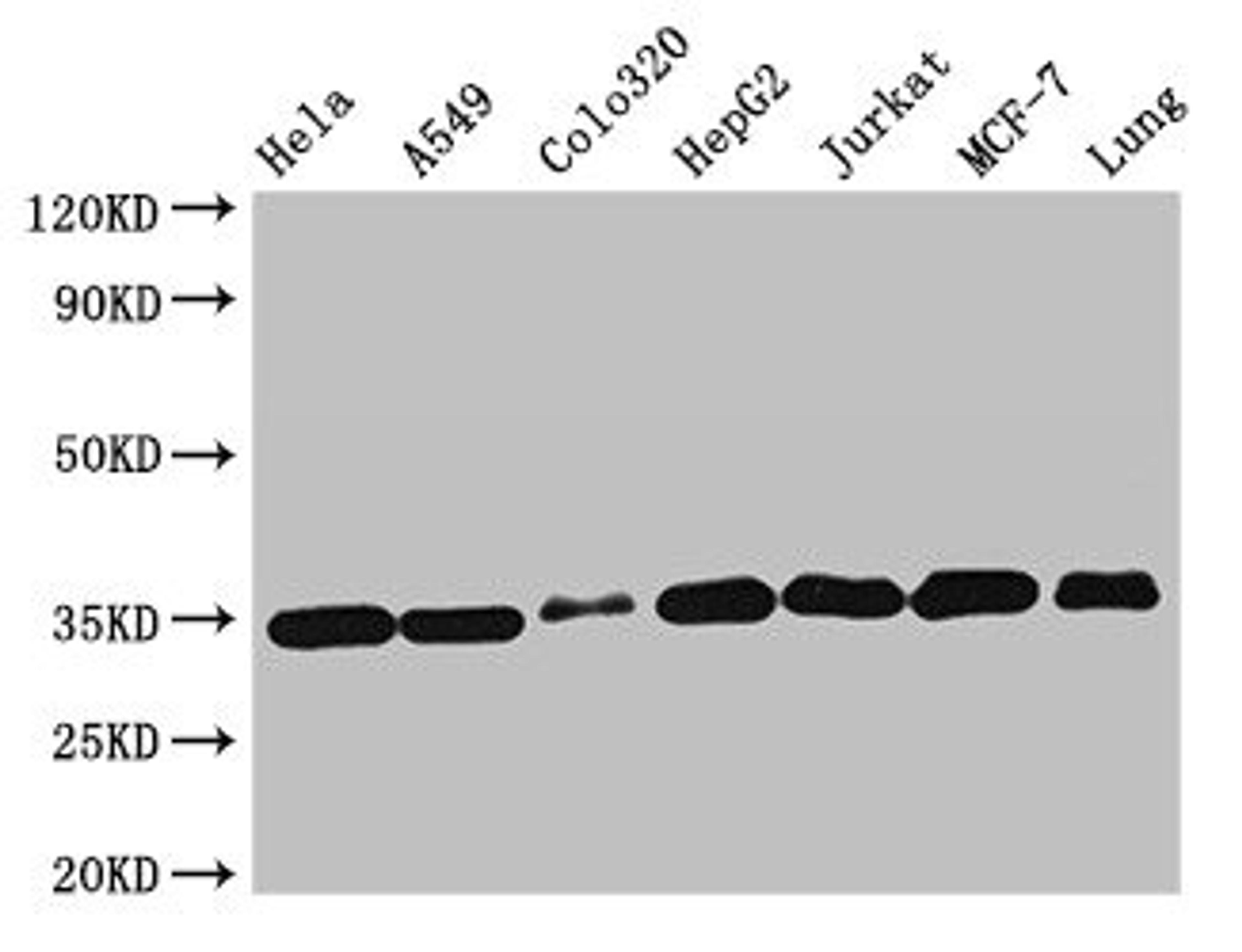 Western Blot. Positive WB detected in: Hela whole cell lysate, A549 whole cell lysate, Colo320 whole cell lysate, HepG2 whole cell lysate, Jurkat whole cell lysate, MCF-7 whole cell lysate, Mouse lung tissue. All lanes: EMD antibody at 2µg/ml. Secondary. Goat polyclonal to rabbit IgG at 1/50000 dilution. Predicted band size: 29 kDa. Observed band size: 35 kDa