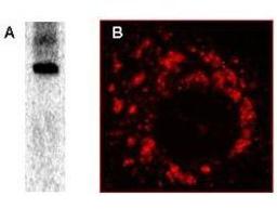 Western blot analysis of post infection of Vero-E6 cells using Sars-Cov Nonstructural Protein 8 antibody