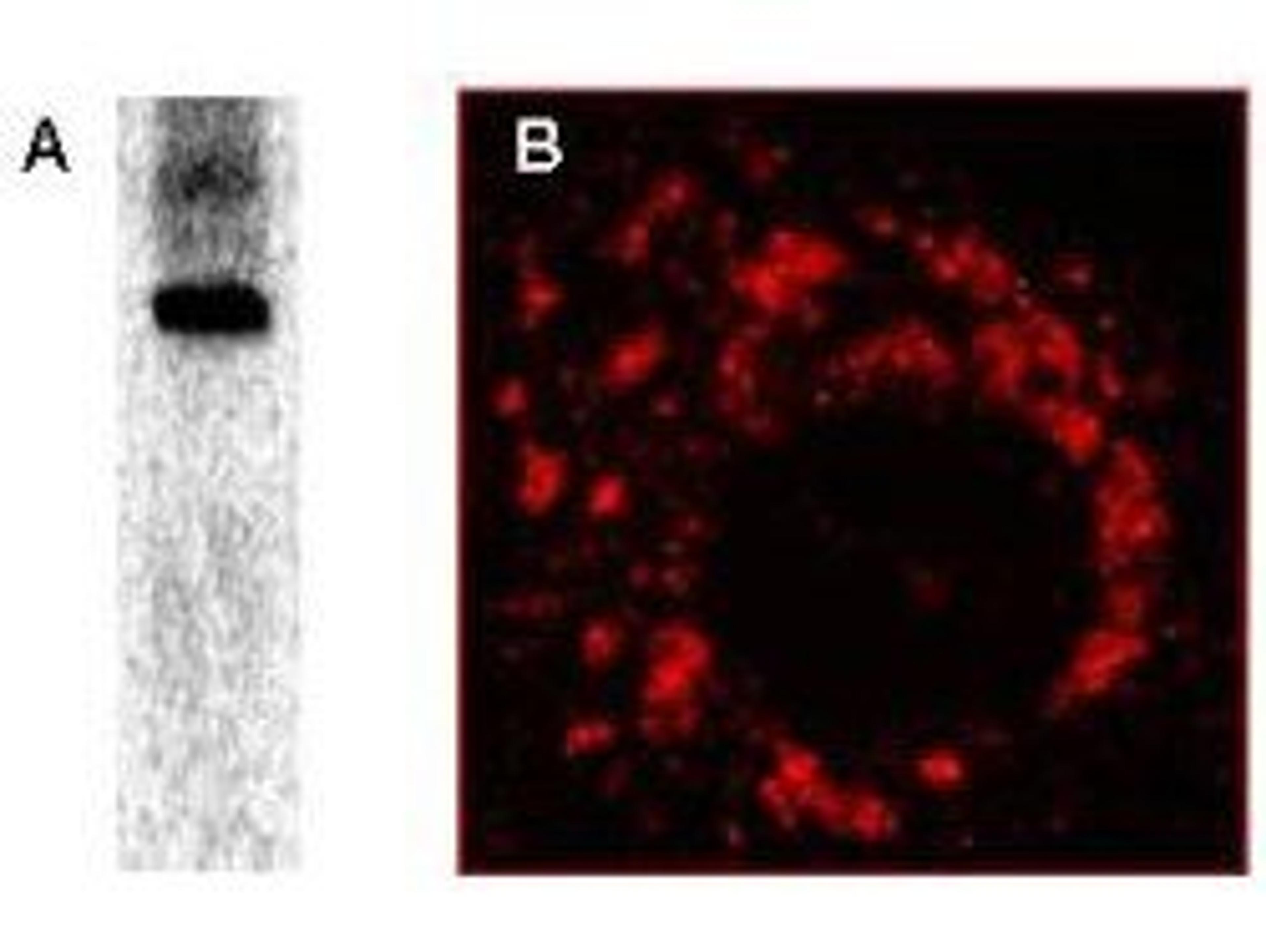 Western blot analysis of post infection of Vero-E6 cells using Sars-Cov Nonstructural Protein 8 antibody