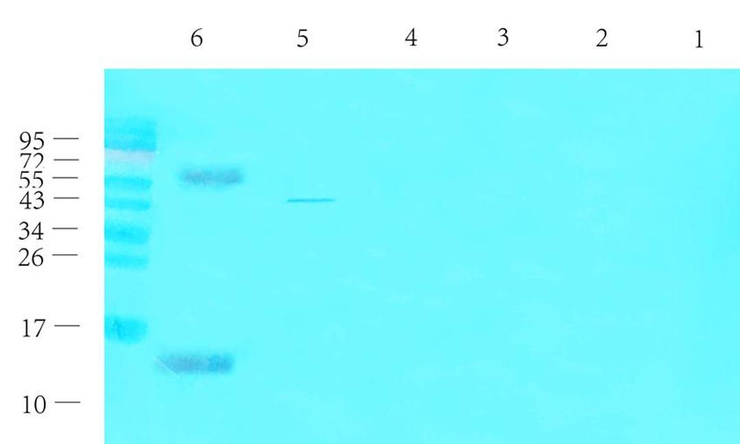 Western blot analysis of rat thyroid (lane 1), rat liver (lane 2), rat pancreas (lane 3), mouse brain (lane 4), mouse spinal cord (lane 5), human thyroid cancer (lane 6) using CGRP antibody (1 ug/ml)