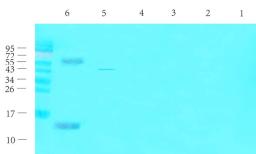 Western blot analysis of rat thyroid (lane 1), rat liver (lane 2), rat pancreas (lane 3), mouse brain (lane 4), mouse spinal cord (lane 5), human thyroid cancer (lane 6) using CGRP antibody (1 ug/ml)