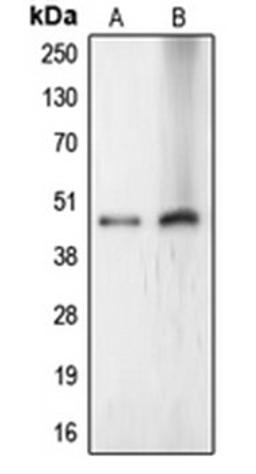 Western blot analysis of HeLa (Lane 1), Jurkat (Lane 2) whole cell lysates using CERS4 antibody