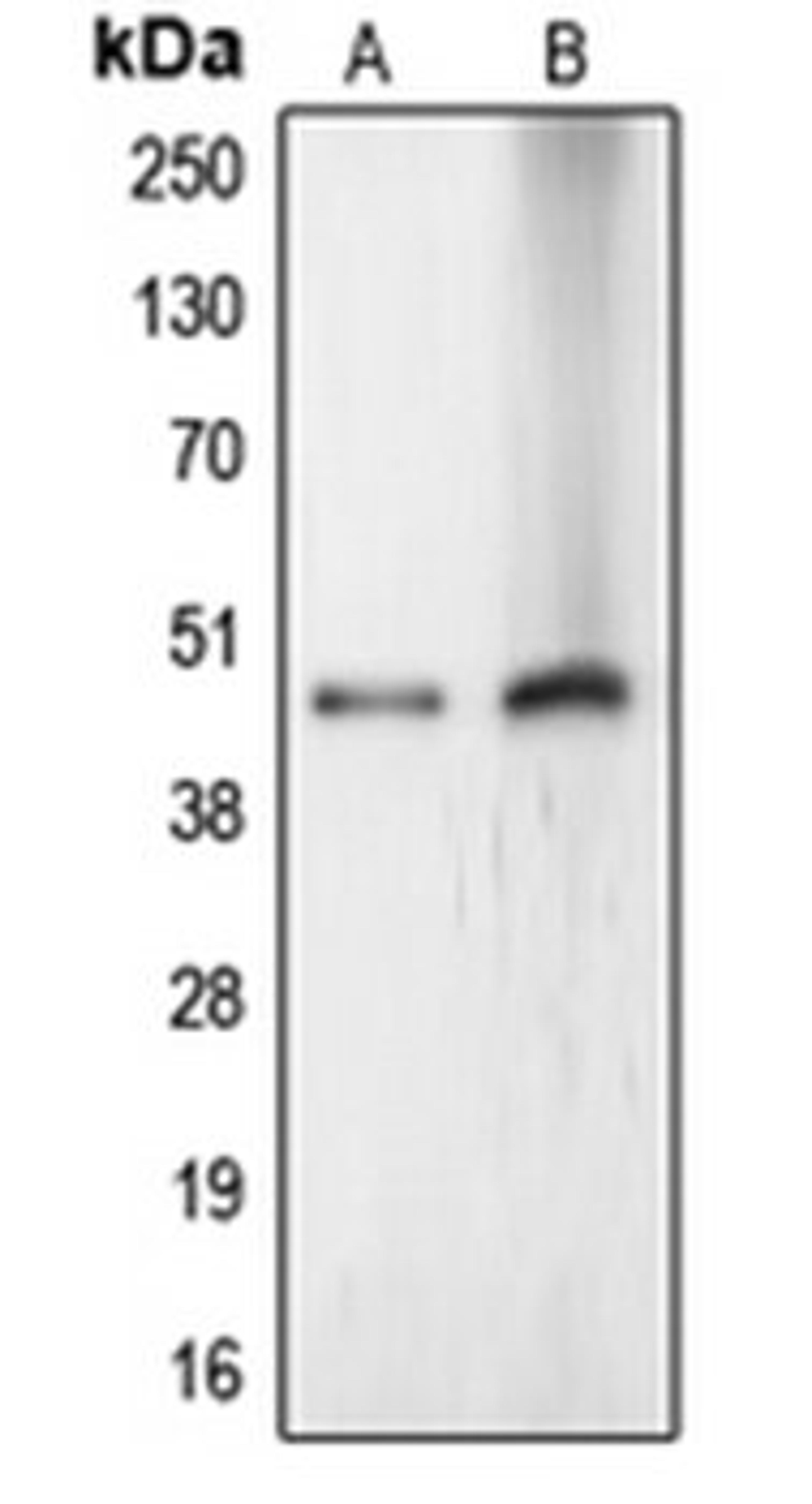 Western blot analysis of HeLa (Lane 1), Jurkat (Lane 2) whole cell lysates using CERS4 antibody