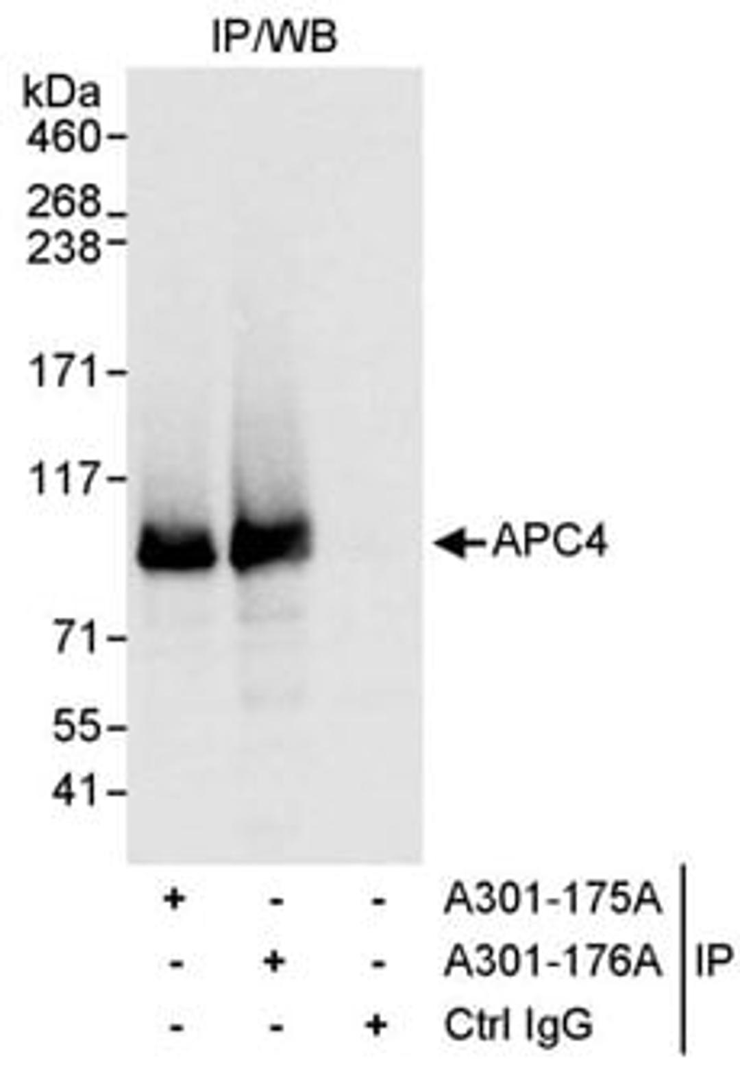 Detection of human APC4 by western blot of immunoprecipitates.