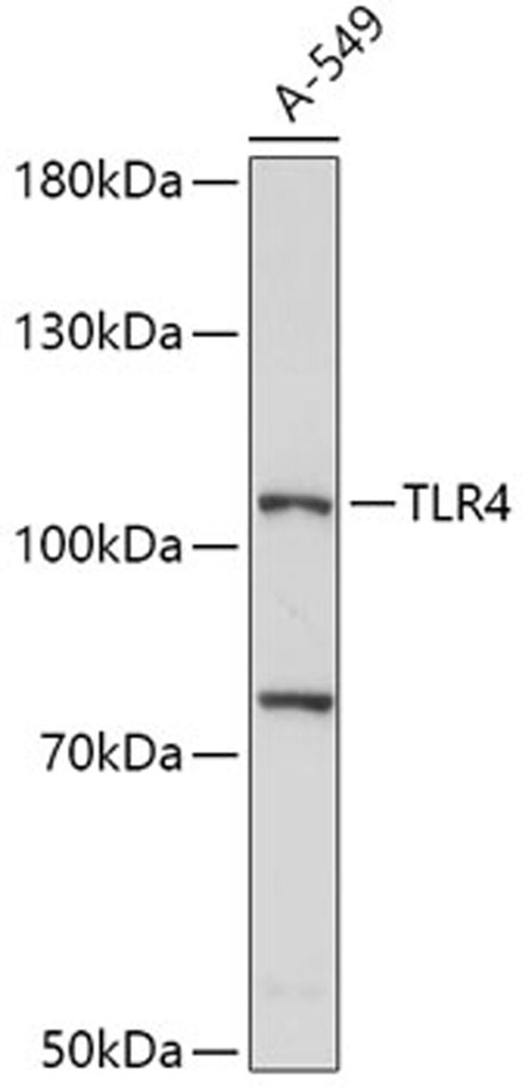 Western blot - TLR4 antibody (A0007)