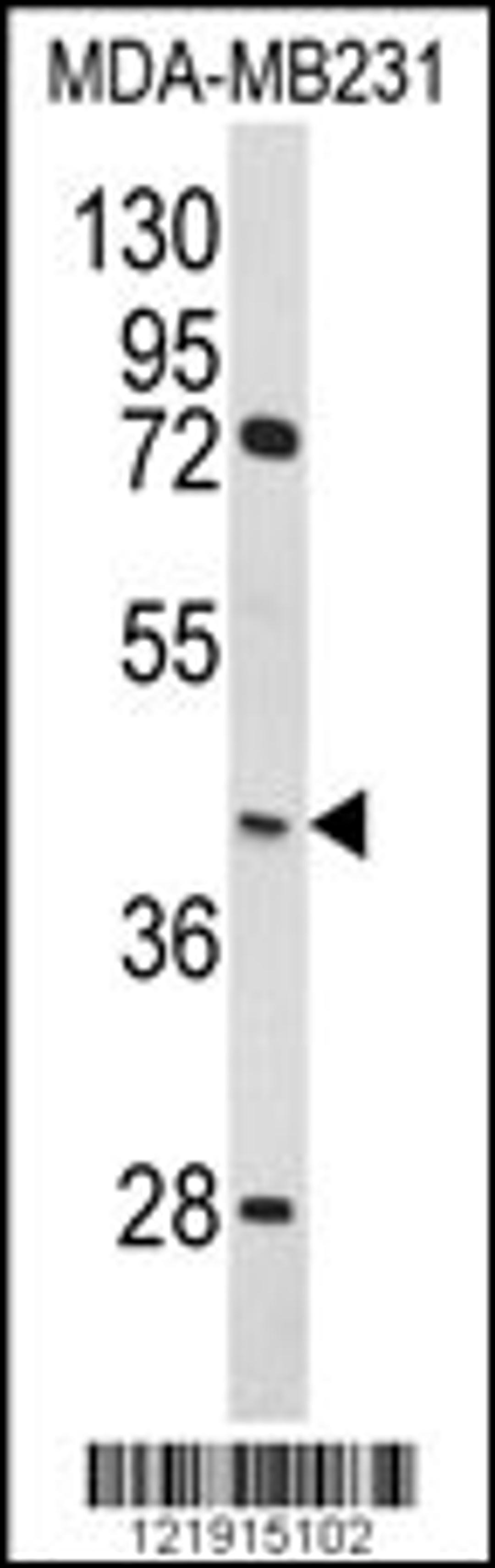 Western blot analysis of HOMER3 Antibody in MDA-MB231 cell line lysates (35ug/lane)