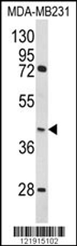 Western blot analysis of HOMER3 Antibody in MDA-MB231 cell line lysates (35ug/lane)