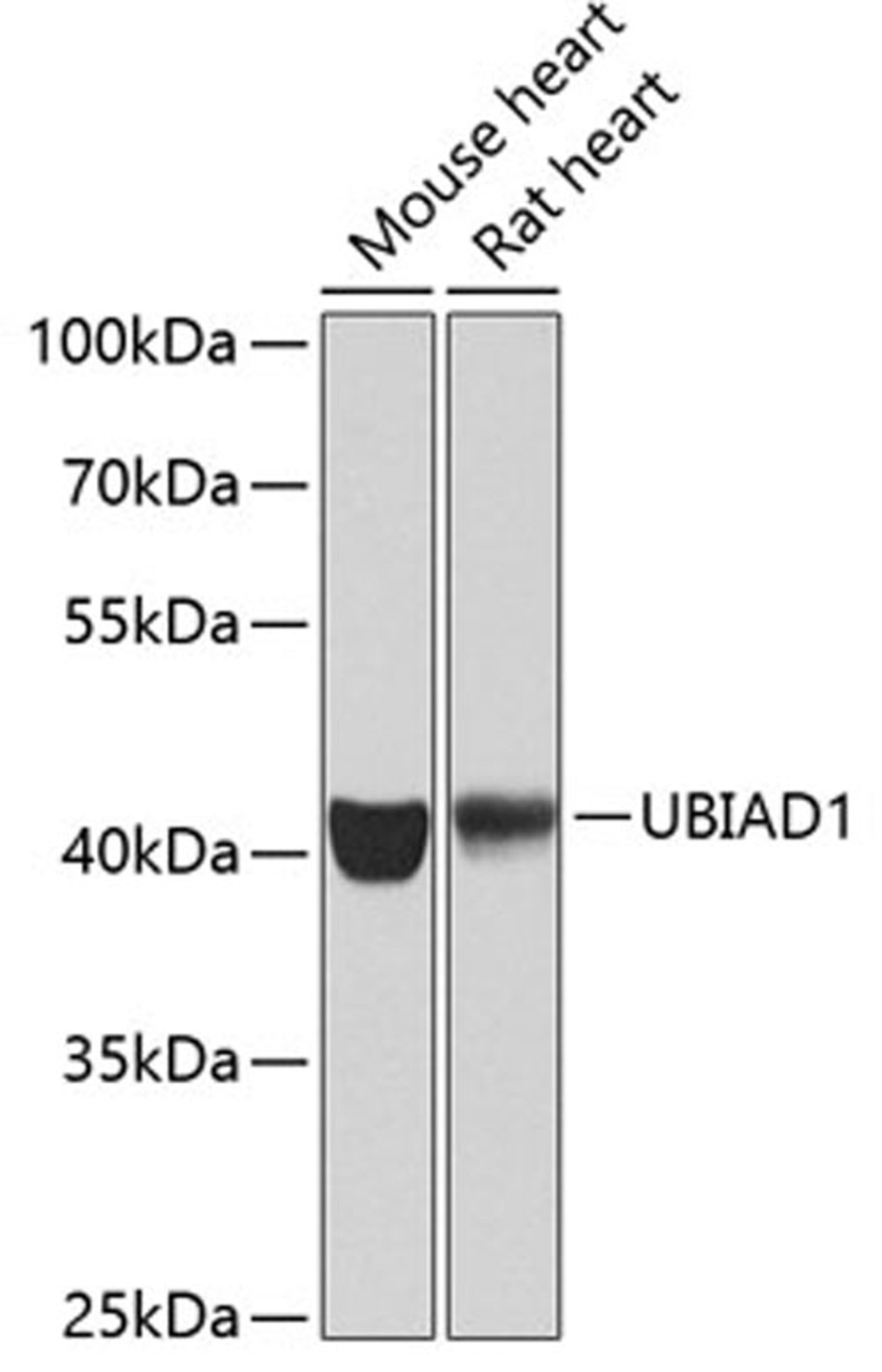 Western blot - UBIAD1 antibody (A7640)