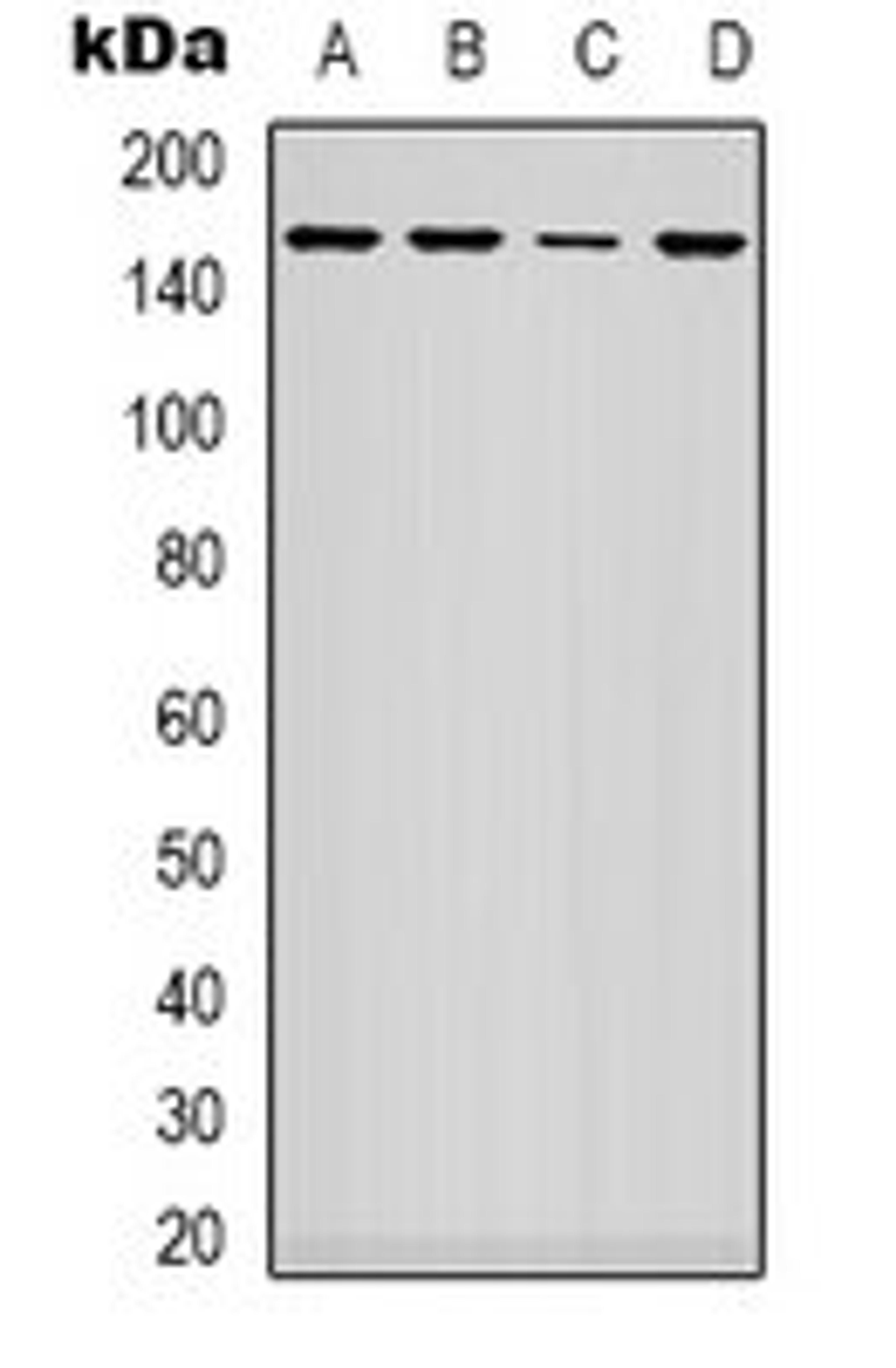 Western blot analysis of A549 (Lane 1), NIH3T3 (Lane 2), HEK293T (Lane 3), mouse heart (Lane 4) whole cell lysates using ARHGAP23 antibody