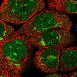 Immunocytochemistry/Immunofluorescence: ARFIP2 Antibody [NBP1-87255] - Staining of human cell line A-431 shows positivity in nucleus, nucleoli & golgi apparatus.