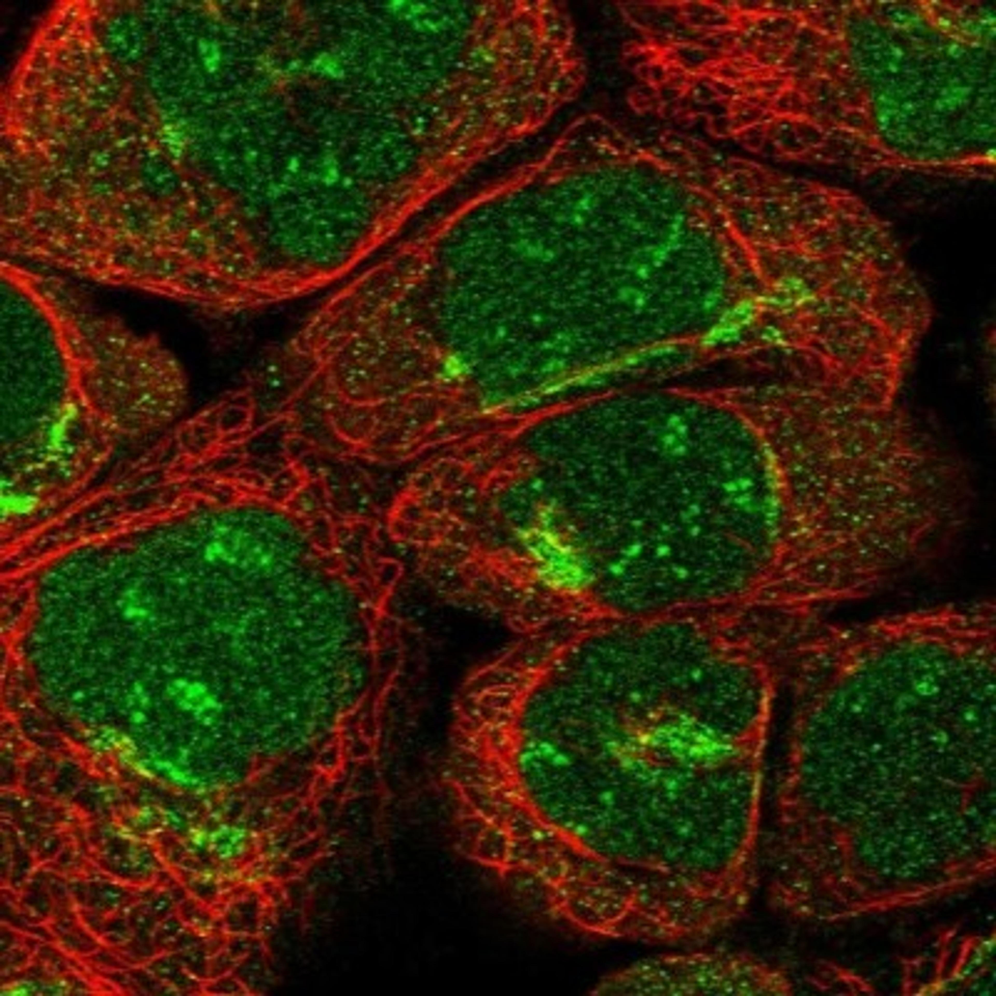 Immunocytochemistry/Immunofluorescence: ARFIP2 Antibody [NBP1-87255] - Staining of human cell line A-431 shows positivity in nucleus, nucleoli & golgi apparatus.