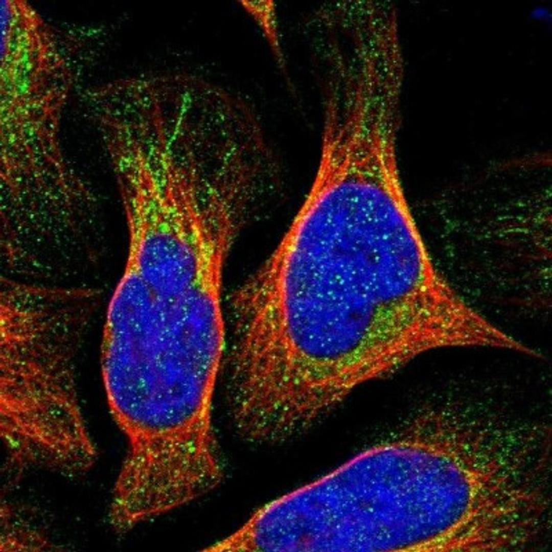 Immunocytochemistry/Immunofluorescence: TTC19 Antibody [NBP1-93979] - Staining of human cell line U-2 OS shows positivity in cytoplasm.