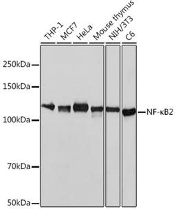 Western blot - NF-?B2 antibody (A19605)