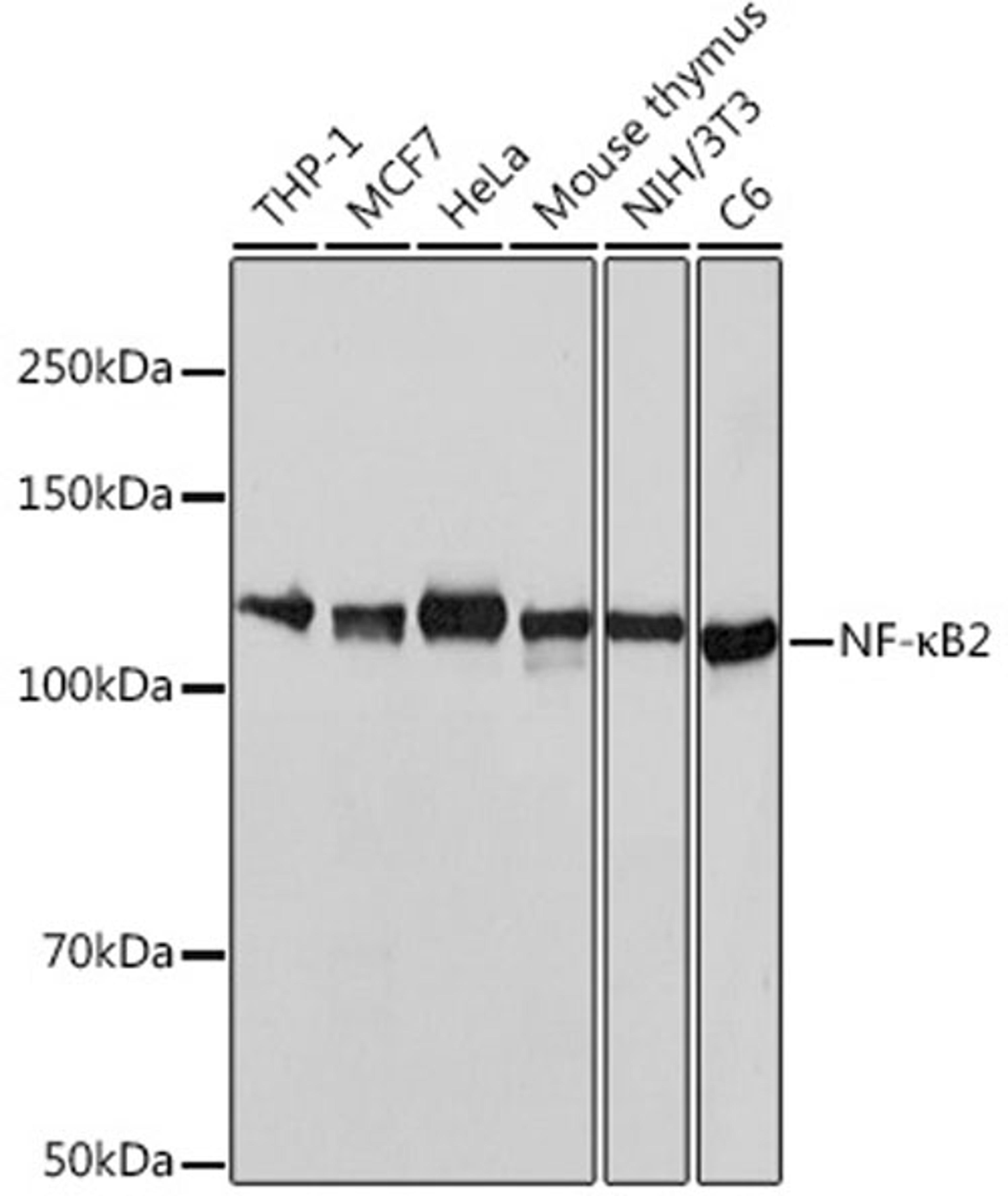 Western blot - NF-?B2 antibody (A19605)