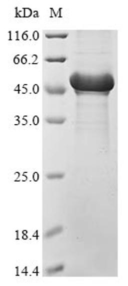 (Tris-Glycine gel) Discontinuous SDS-PAGE (reduced) with 5% enrichment gel and 15% separation gel.