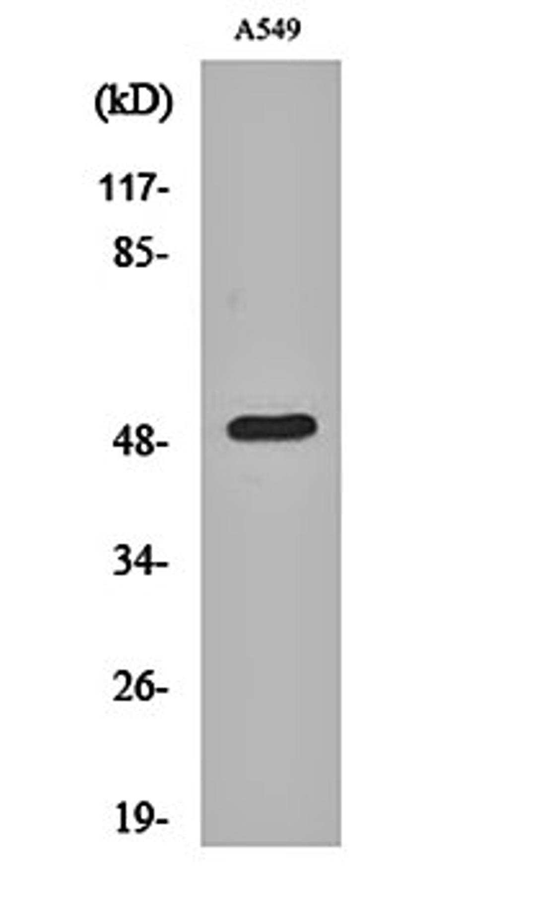 Western blot analysis of A549 cell lysates using Dynactin 2 antibody