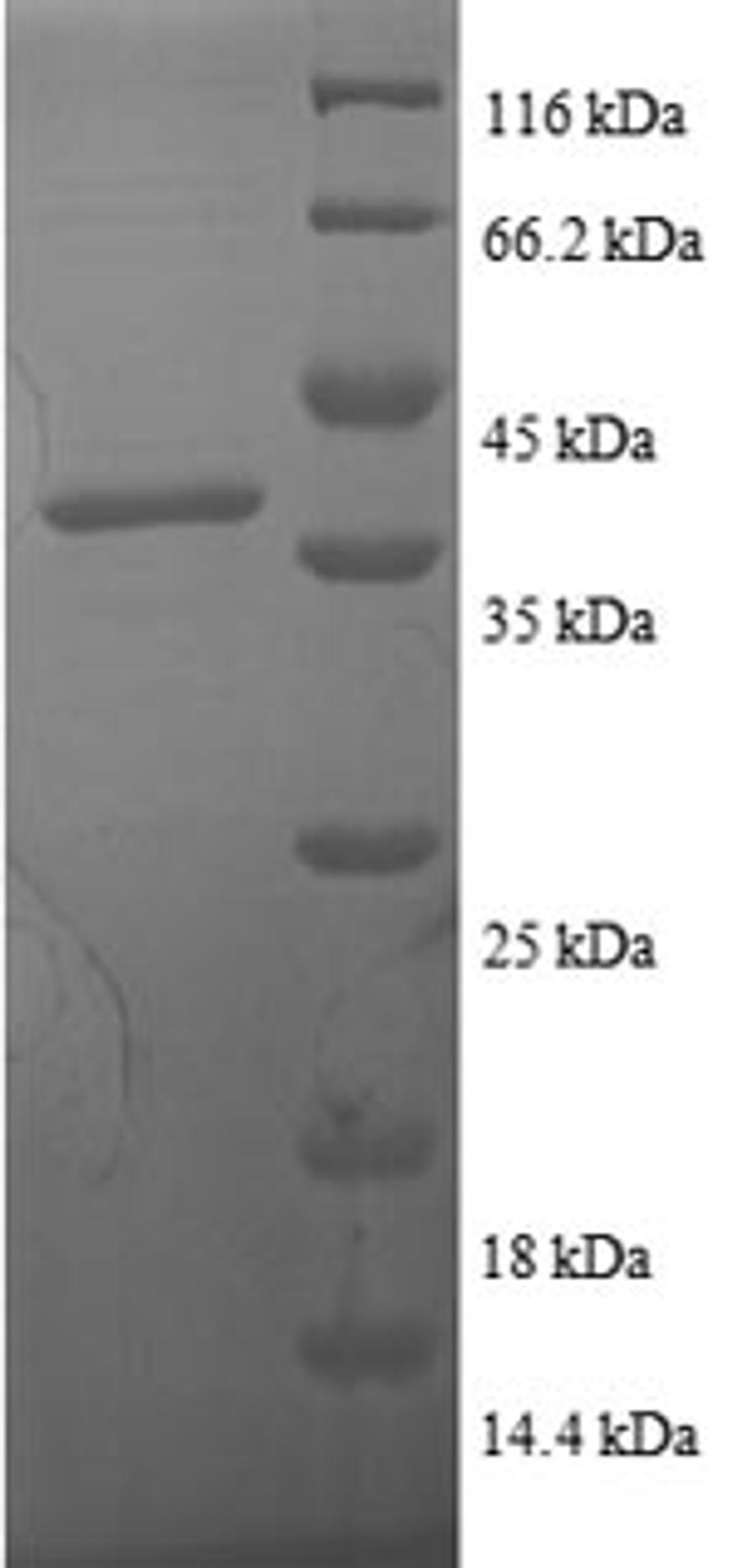 (Tris-Glycine gel) Discontinuous SDS-PAGE (reduced) with 5% enrichment gel and 15% separation gel.
