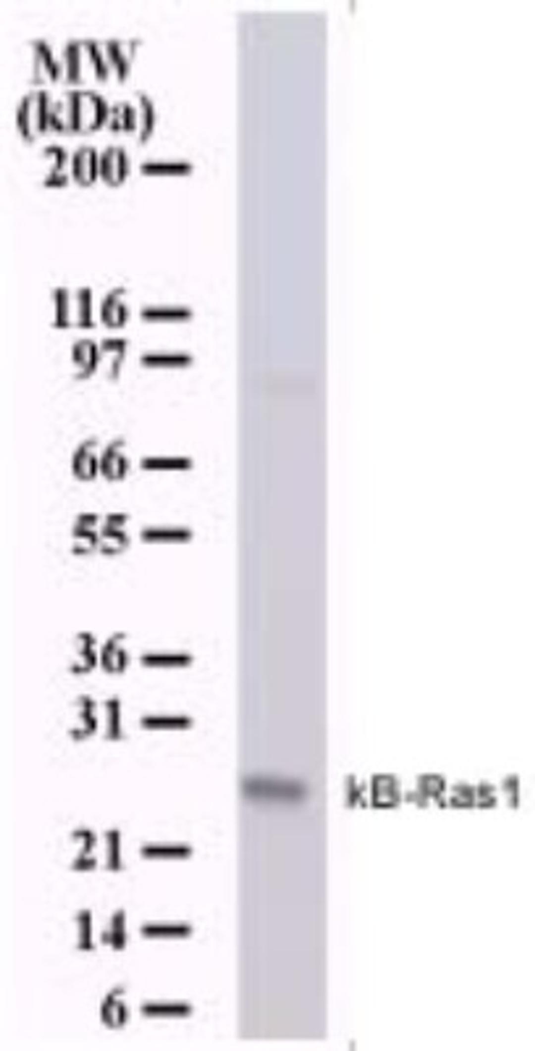 Western Blot: NKIRAS1 Antibody (184C278) [NB100-56555] - Analysis of NKIRAS1 using this antibody. Human 293 cell lysate probed with kB-Ras1 antibody at 0.5 ug/ml.