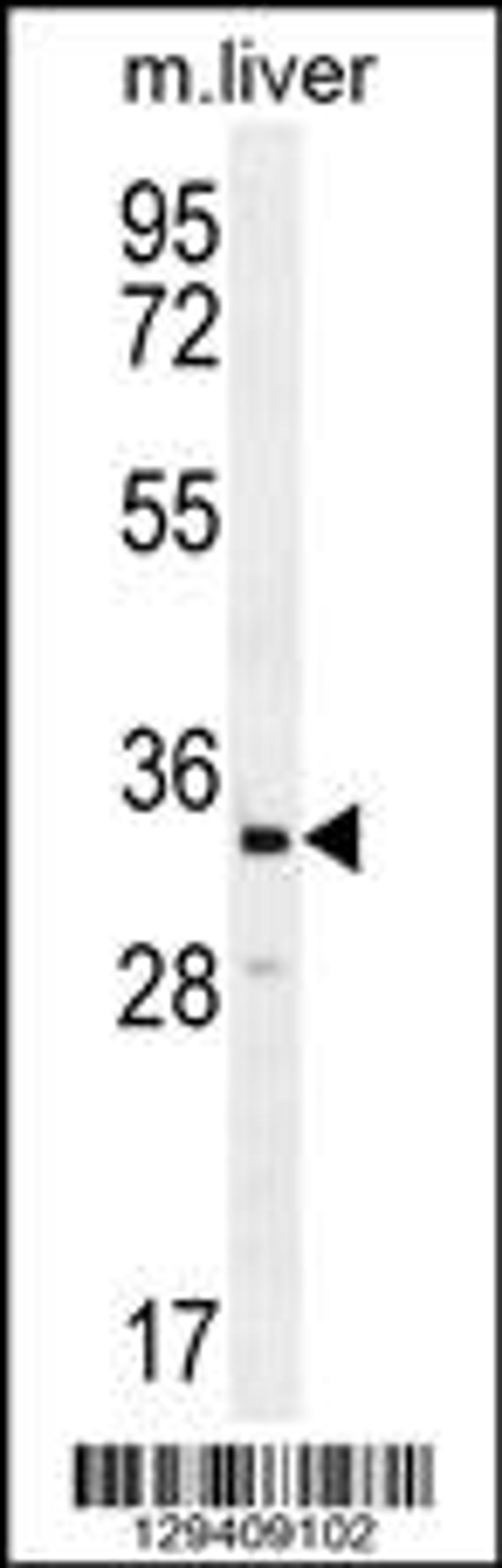 Western blot analysis in mouse liver tissue lysates (35ug/lane).