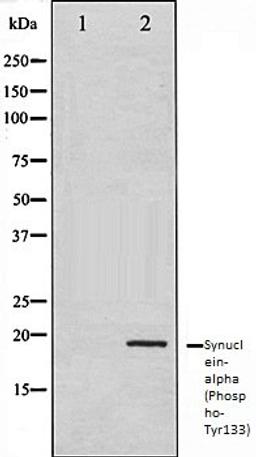 Western blot analysis of 293 whole cell lysates using Synuclein- alpha (Phospho-Tyr133) antibody, The lane on the left is treated with the antigen-specific peptide.