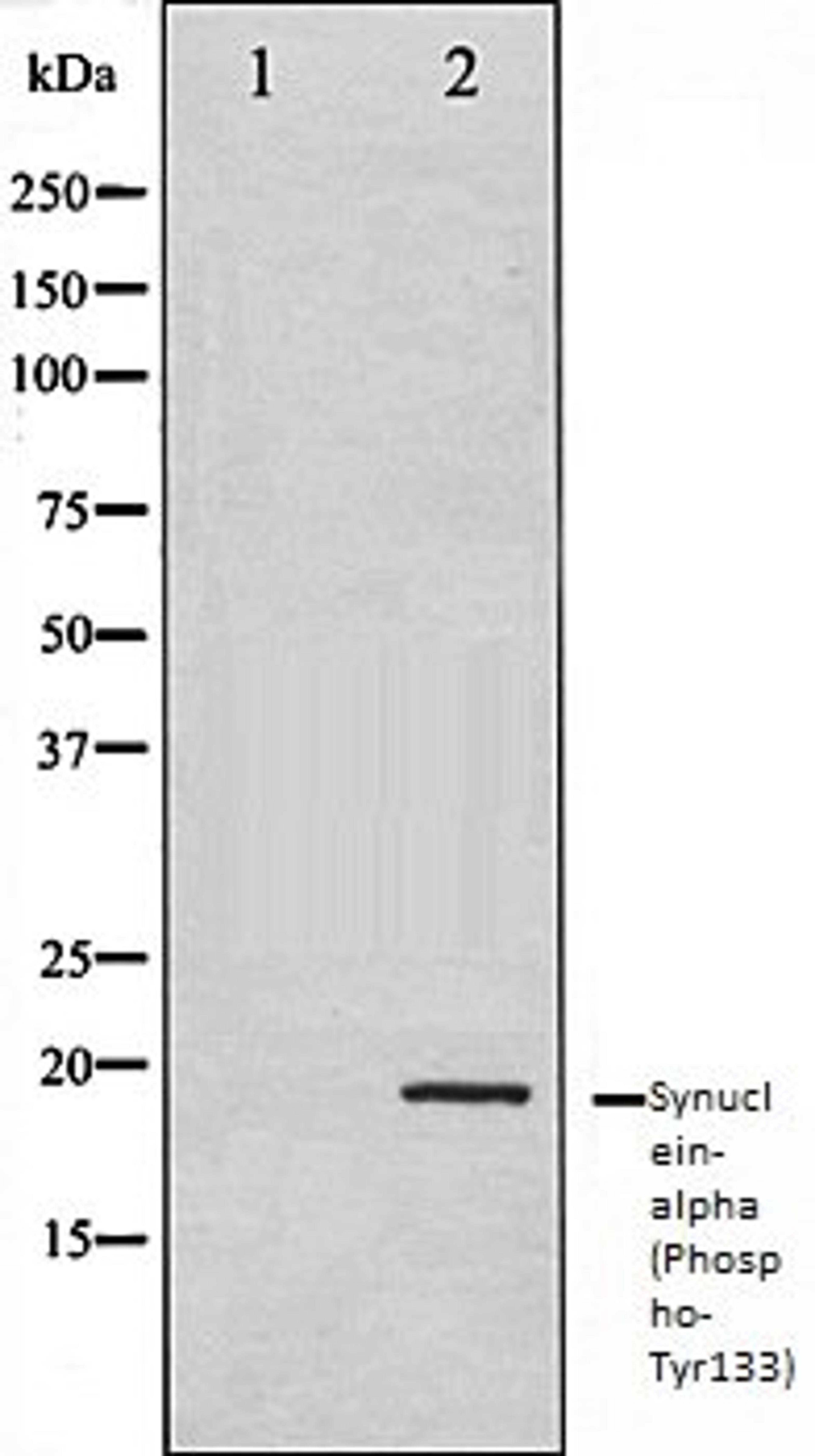 Western blot analysis of 293 whole cell lysates using Synuclein- alpha (Phospho-Tyr133) antibody, The lane on the left is treated with the antigen-specific peptide.