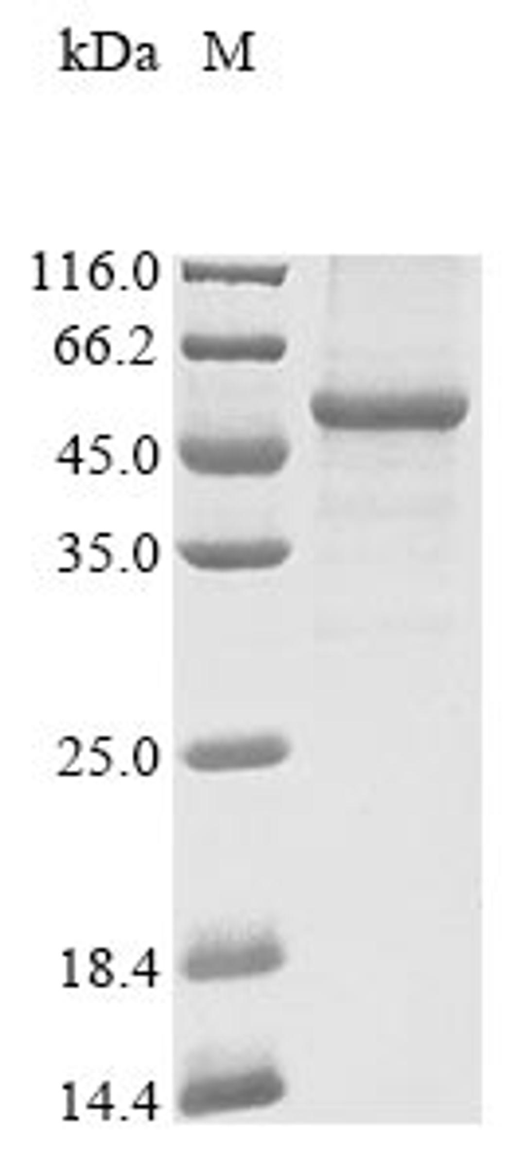 (Tris-Glycine gel) Discontinuous SDS-PAGE (reduced) with 5% enrichment gel and 15% separation gel.