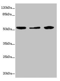 Western blot. All lanes: KYNU antibody at 3.26ug/ml. Lane 1: A549 whole cell lysate. Lane 2: HepG2 whole cell lysate. Lane 3: THP-1 whole cell lysate. Secondary. Goat polyclonal to rabbit IgG at 1/10000 dilution. Predicted band size: 53, 35 kDa. Observed band size: 53 kDa.