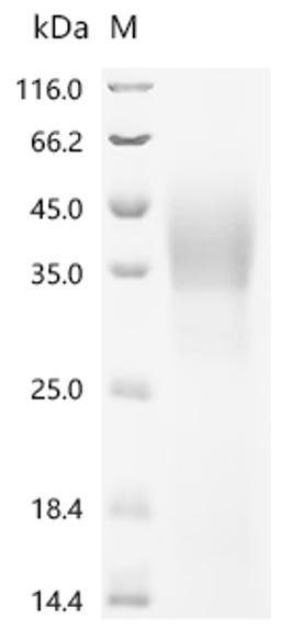 (Tris-Glycine gel) Discontinuous SDS-PAGE (reduced) with 5% enrichment gel and 15% separation gel.