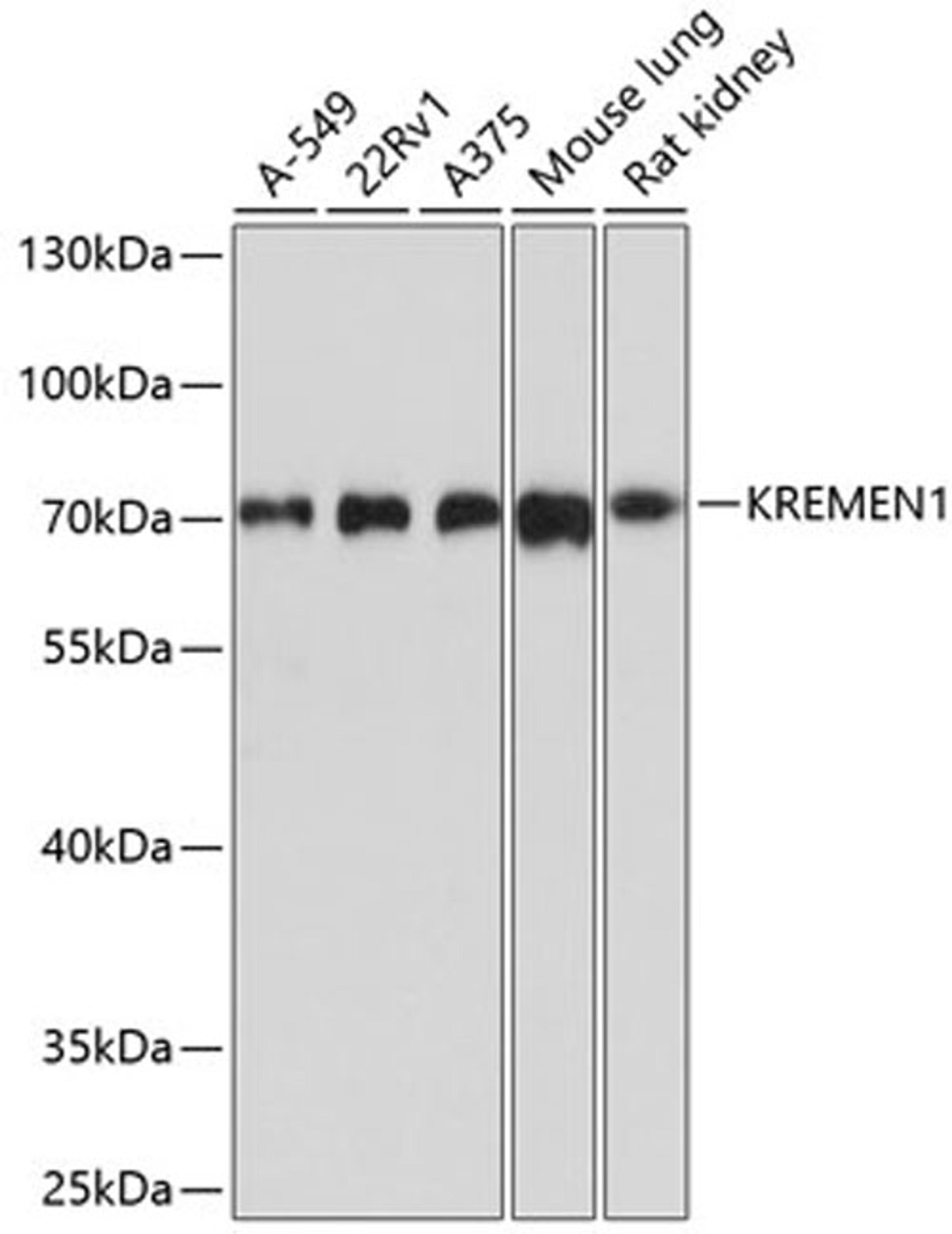 Western blot - KREMEN1 antibody (A10507)