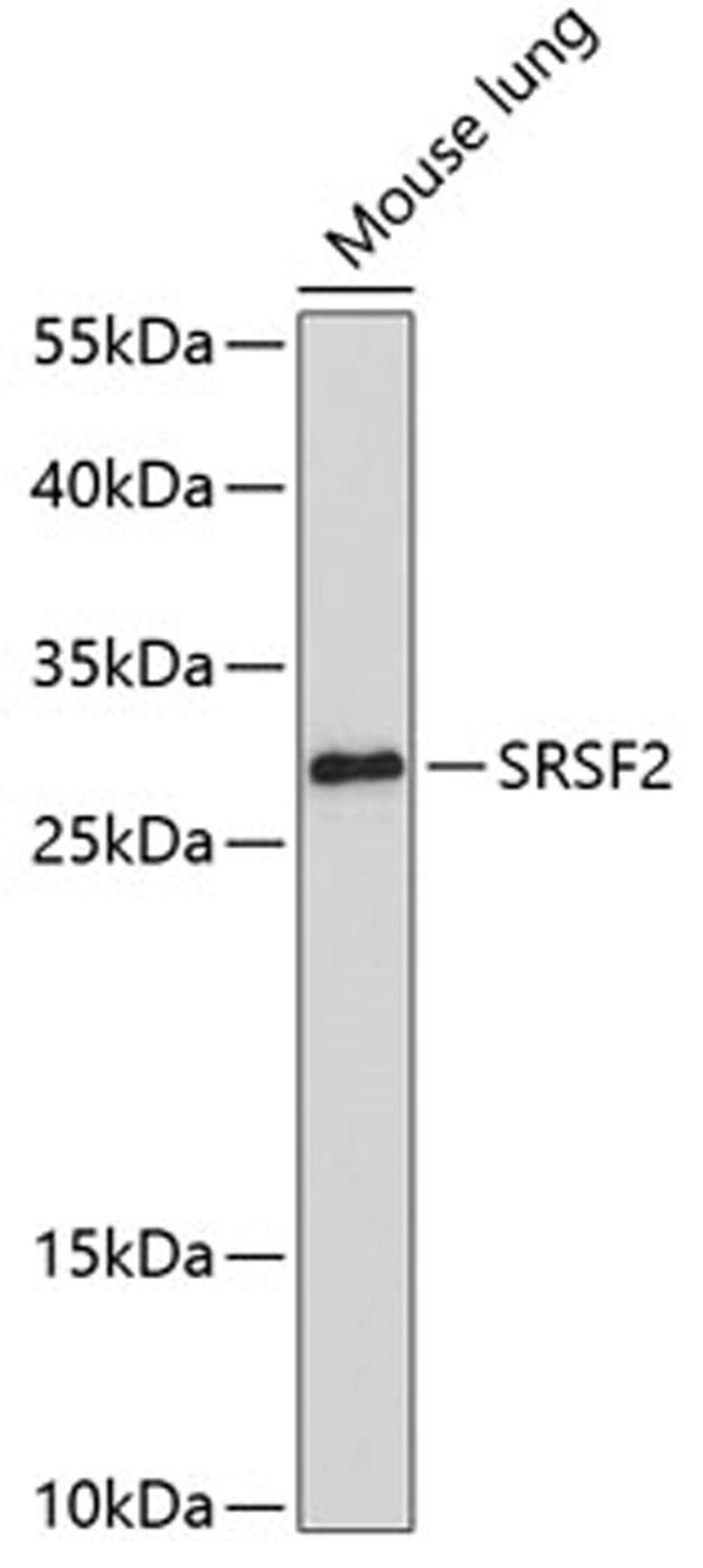 Western blot - SRSF2 antibody (A3635)