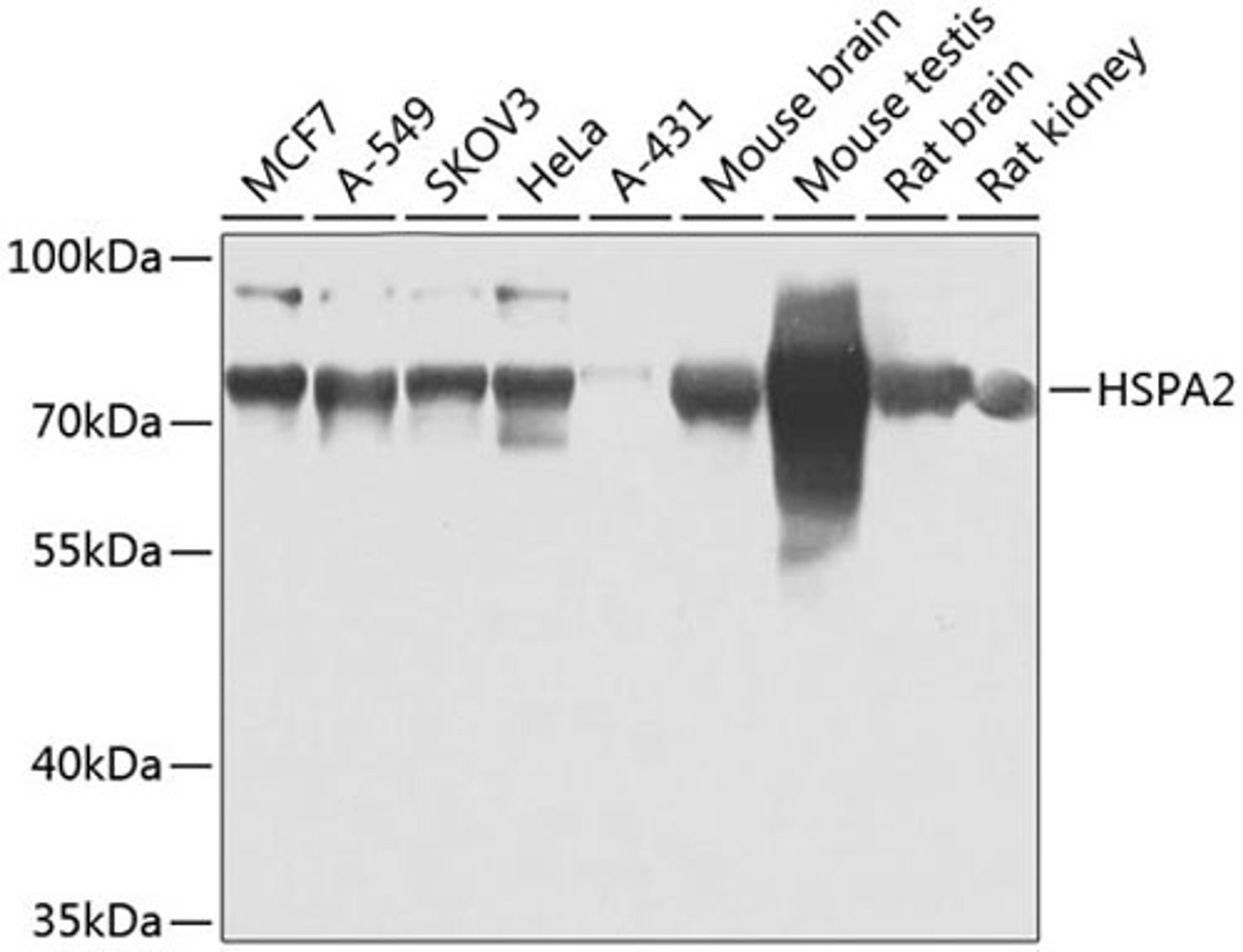 Western blot - HSPA2 antibody (A7902)