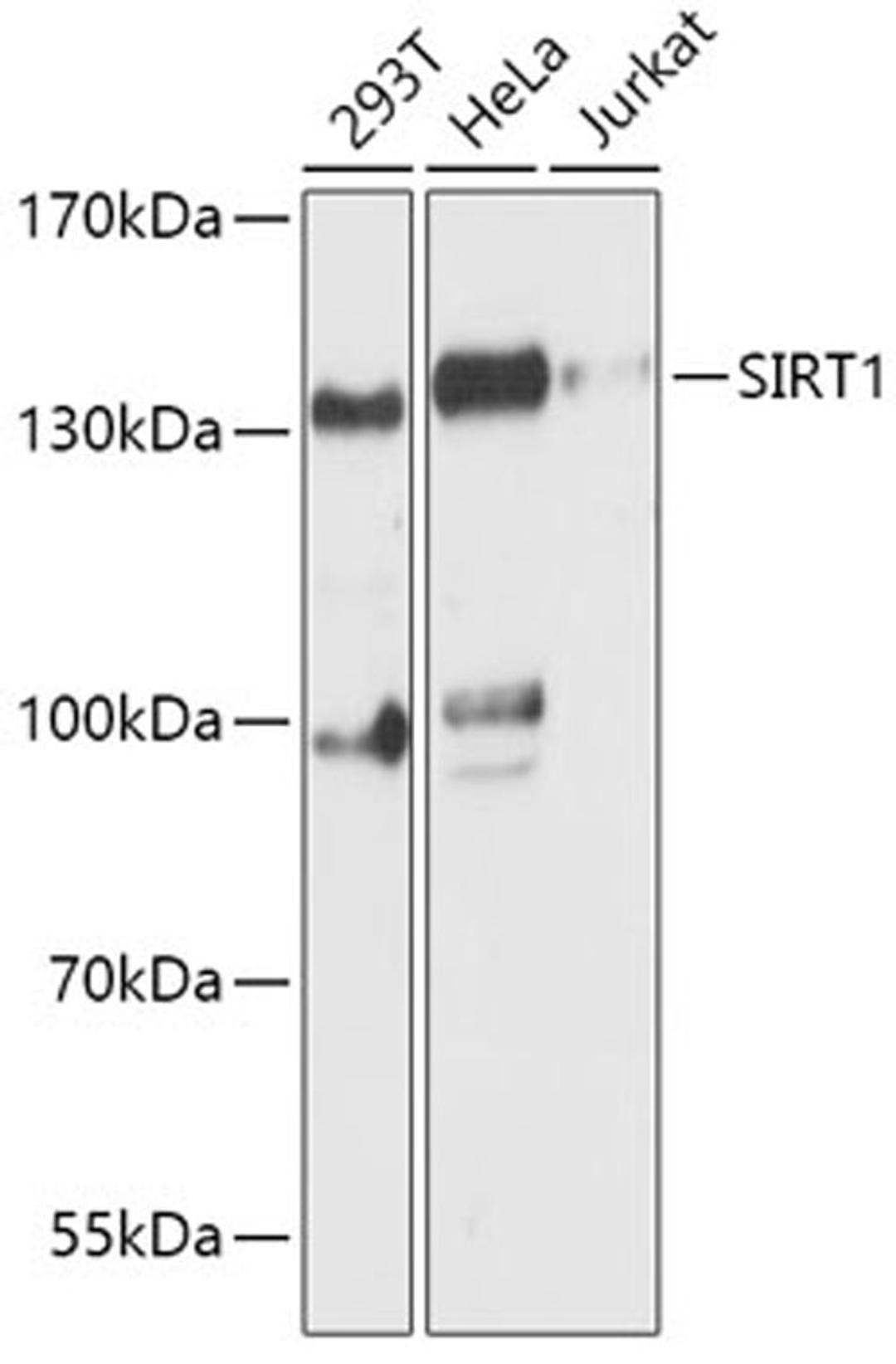 Western blot - SIRT1 antibody (A11267)