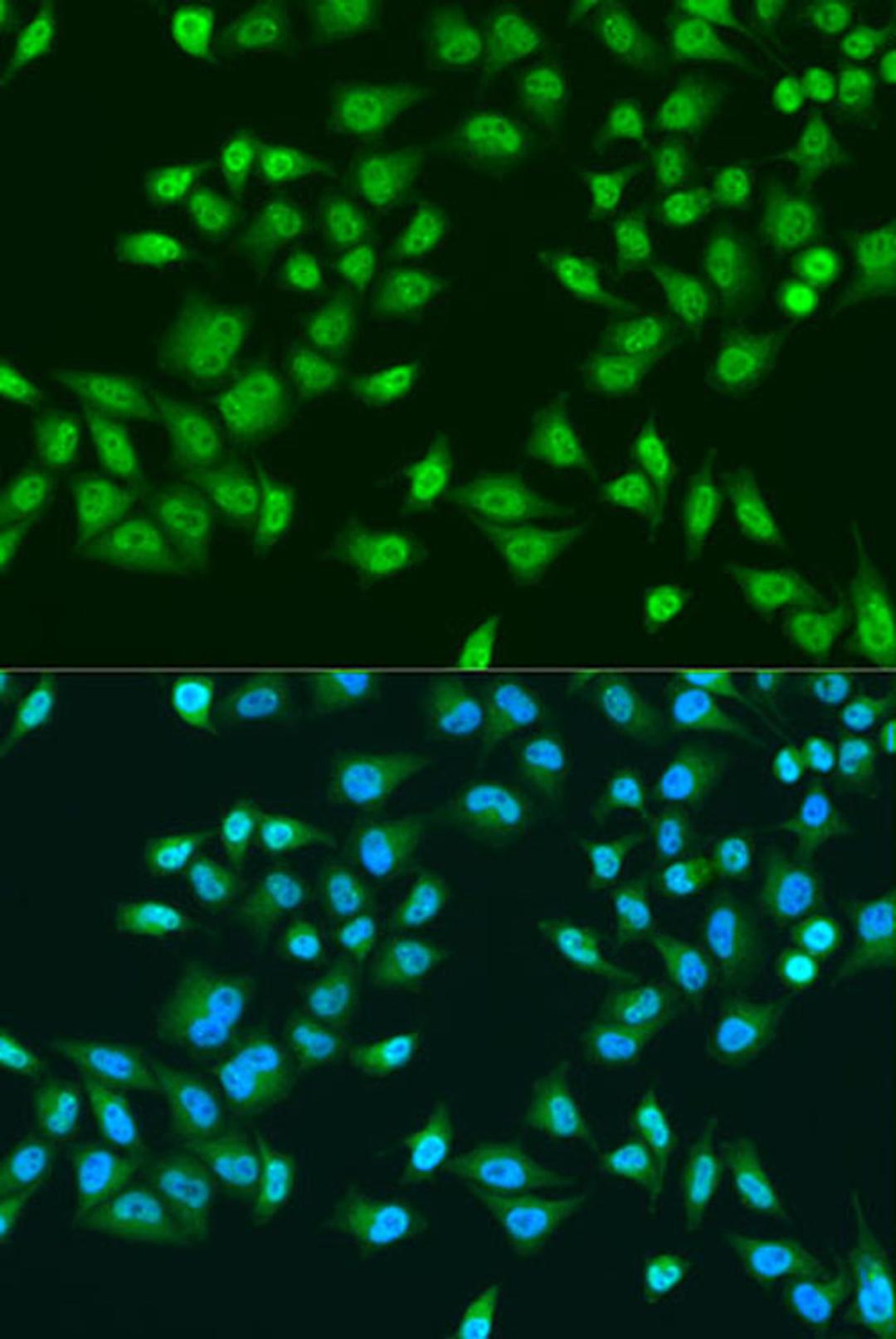 Immunofluorescence - RPS6KB1 antibody (A15719)