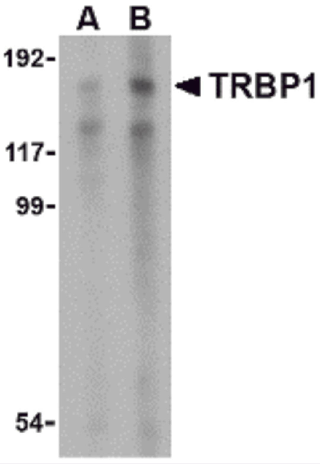 Western blot analysis of TRBP1 in 3T3 cell lysate with TRBP1 antibody at (A) 1 and (B) 2 &#956;g/mL.