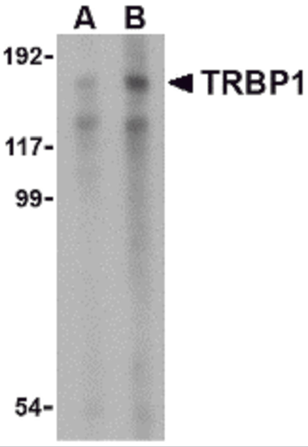 Western blot analysis of TRBP1 in 3T3 cell lysate with TRBP1 antibody at (A) 1 and (B) 2 μg/mL.
