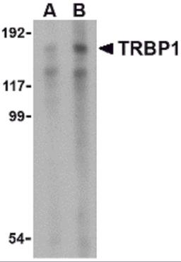 Western blot analysis of TRBP1 in 3T3 cell lysate with TRBP1 antibody at (A) 1 and (B) 2 μg/mL.