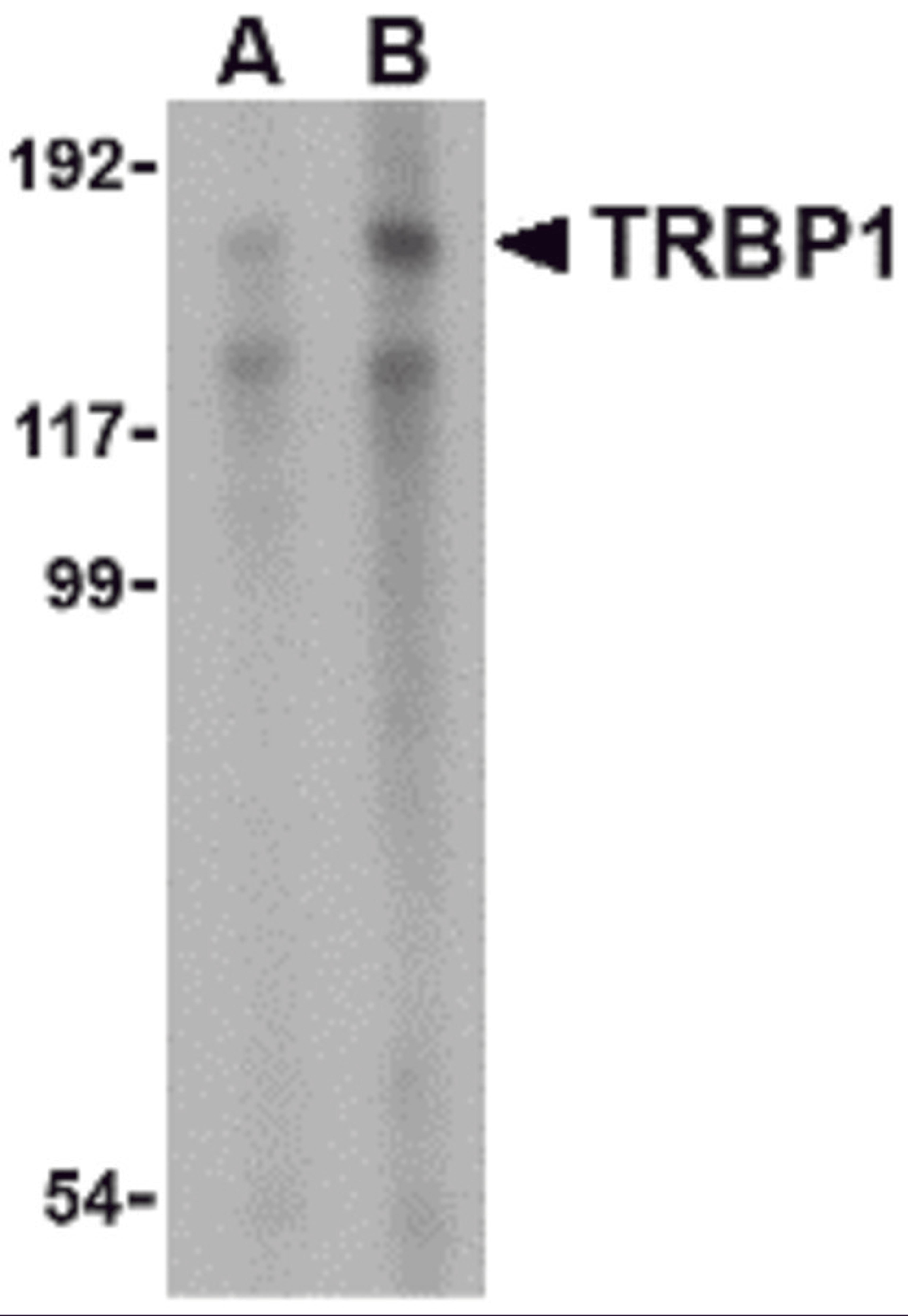 Western blot analysis of TRBP1 in 3T3 cell lysate with TRBP1 antibody at (A) 1 and (B) 2 μg/mL.