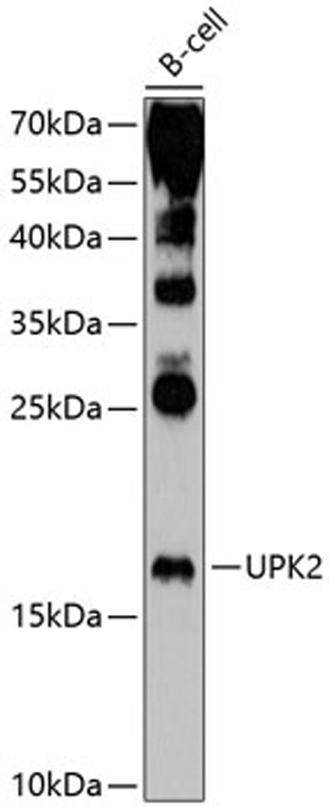 Western blot - UPK2 antibody (A10813)