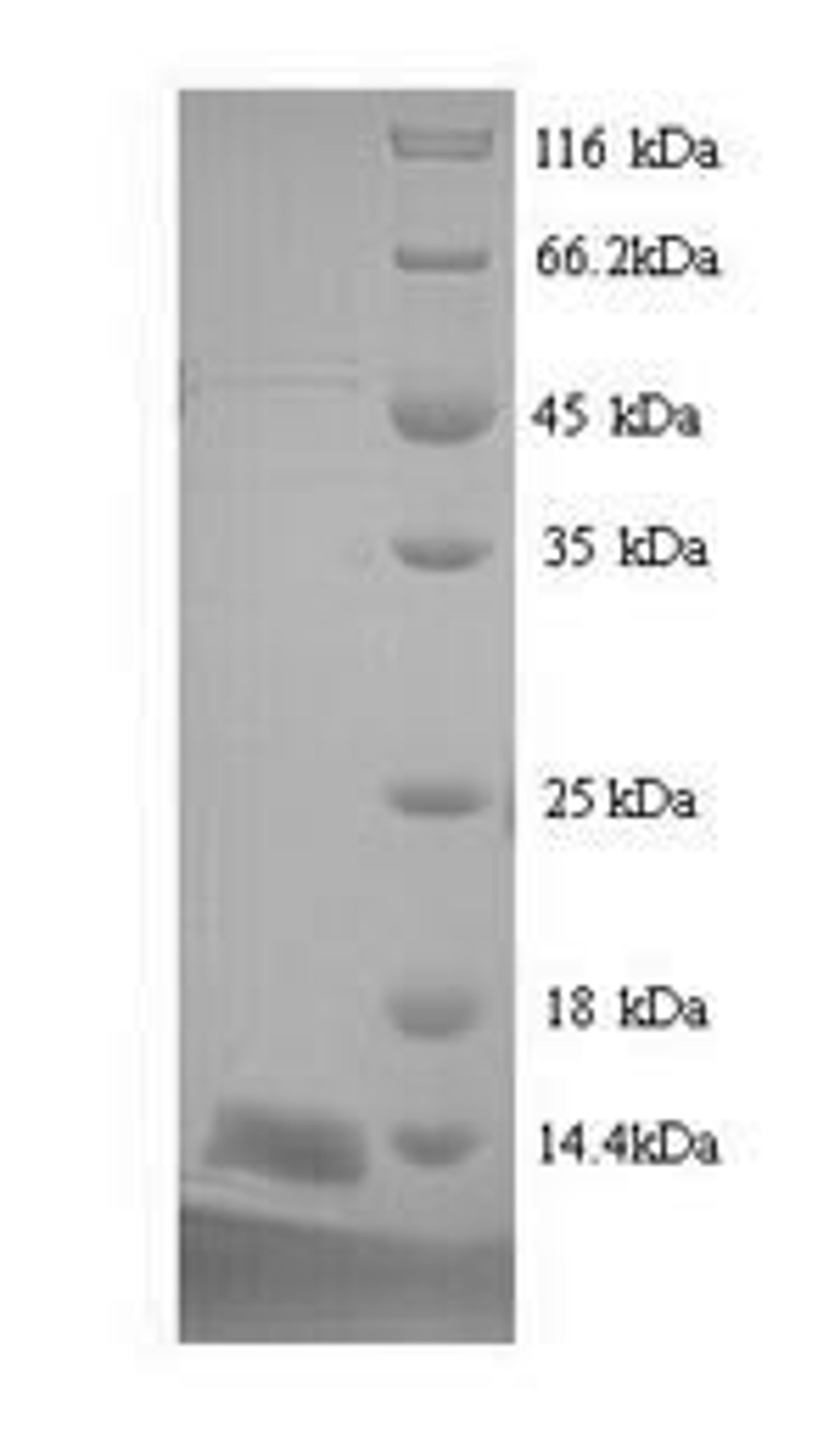 (Tris-Glycine gel) Discontinuous SDS-PAGE (reduced) with 5% enrichment gel and 15% separation gel.