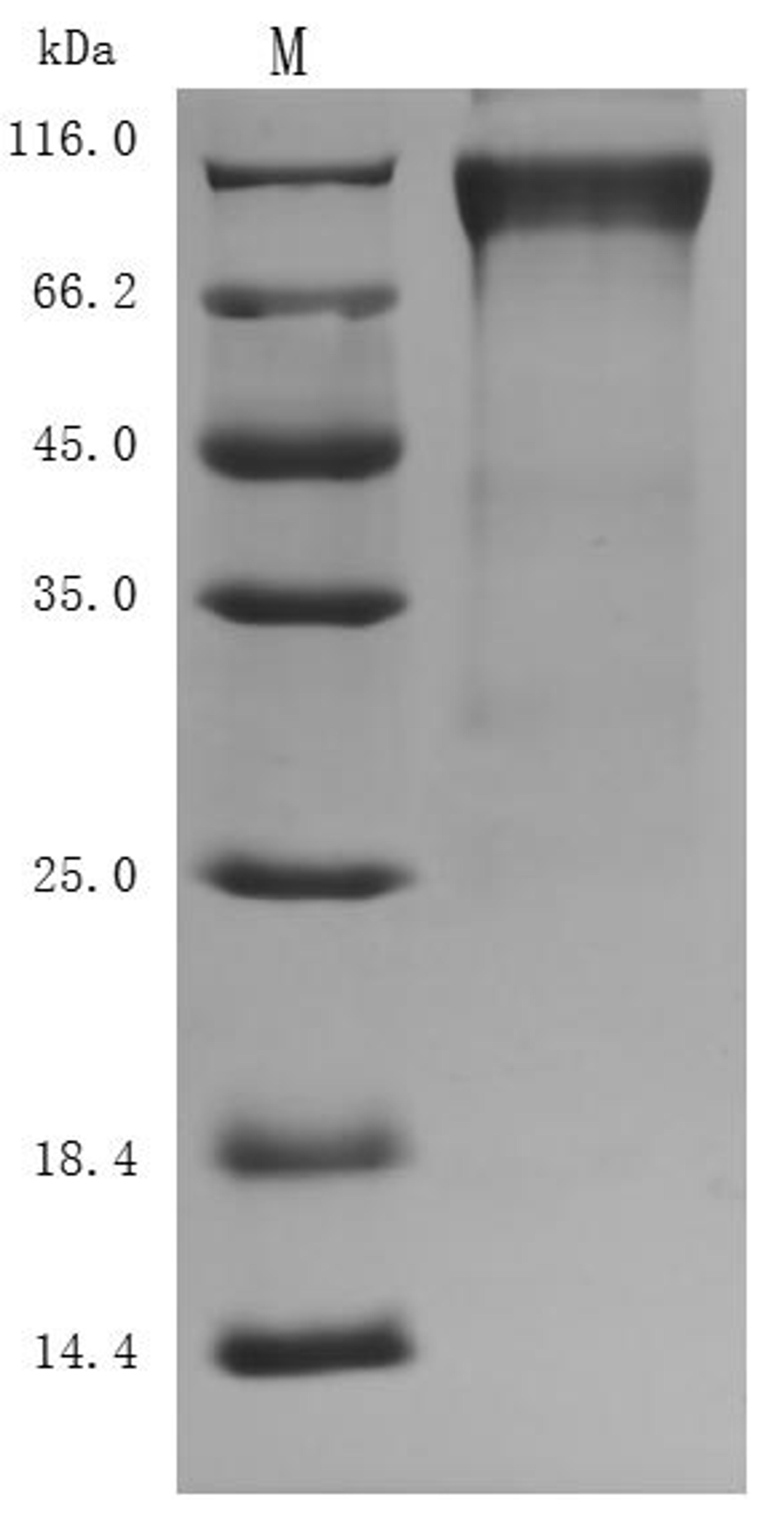 (Tris-Glycine gel) Discontinuous SDS-PAGE (reduced) with 5% enrichment gel and 15% separation gel.