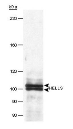 Western Blot: SMARCA6 Antibody [NB100-278] - Western Blot of Immunoprecipitated human HELLS, using NB100-278. Sample: Nuclear extract (1 mg) from HeLa cells.