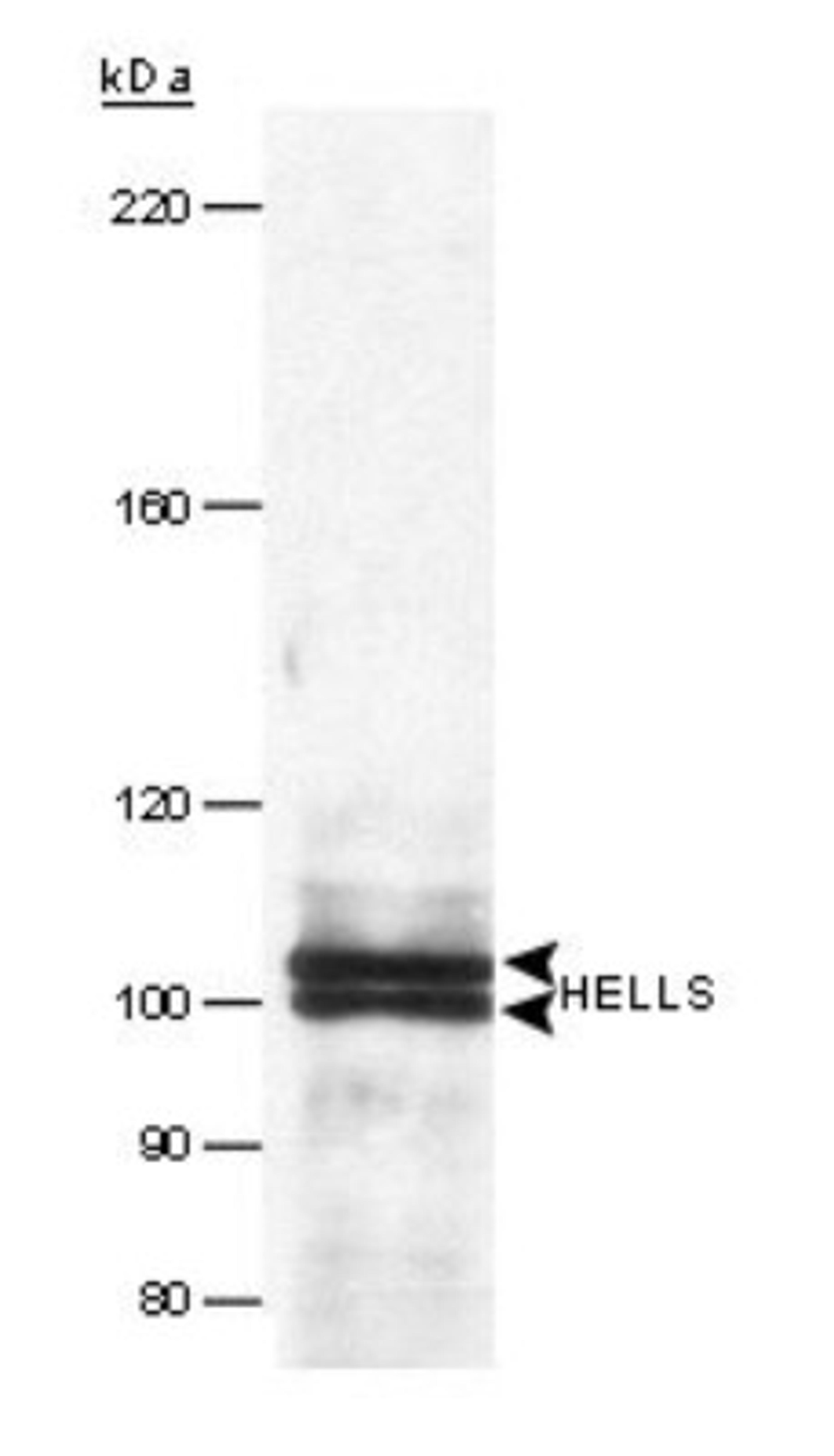 Western Blot: SMARCA6 Antibody [NB100-278] - Western Blot of Immunoprecipitated human HELLS, using NB100-278. Sample: Nuclear extract (1 mg) from HeLa cells.