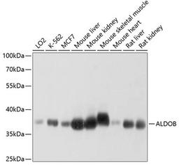 Western blot - ALDOB antibody (A3728)