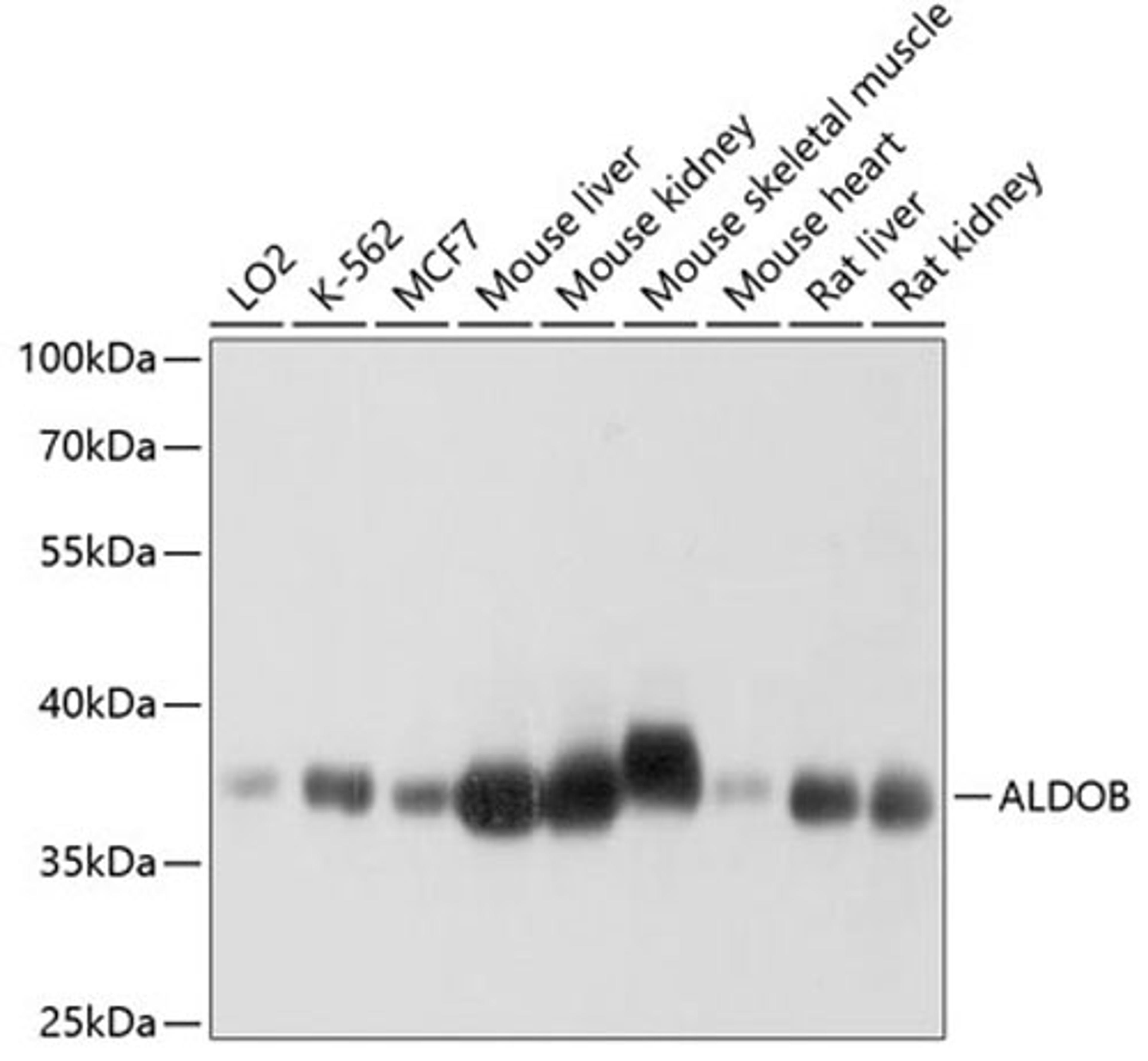 Western blot - ALDOB antibody (A3728)