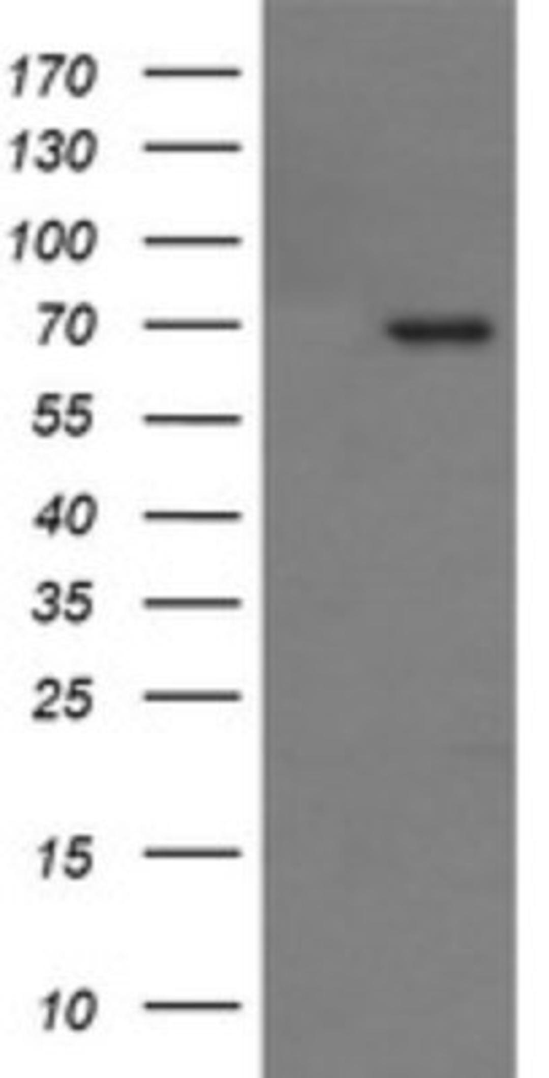 Western Blot: TP73-AS1 Antibody (2H5) [NBP2-45999] - Analysis of HEK293T cells were transfected with the pCMV6-ENTRY control (Left lane) or pCMV6-ENTRY TP73.