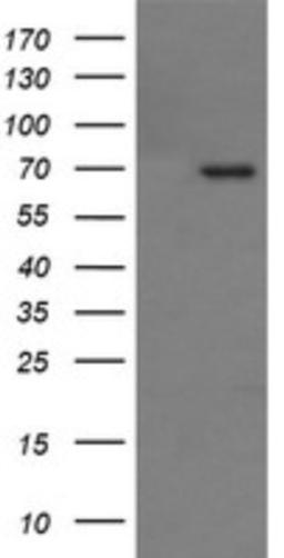 Western Blot: TP73-AS1 Antibody (2H5) [NBP2-45999] - Analysis of HEK293T cells were transfected with the pCMV6-ENTRY control (Left lane) or pCMV6-ENTRY TP73.