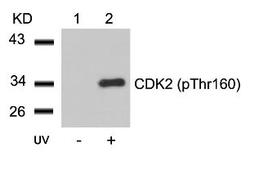 Western blot analysis of lysed extracts from HeLa cells untreated (Lane 1) or treated with UV (lane 2) using CDK2 (Phospho-Thr160) Antibody.