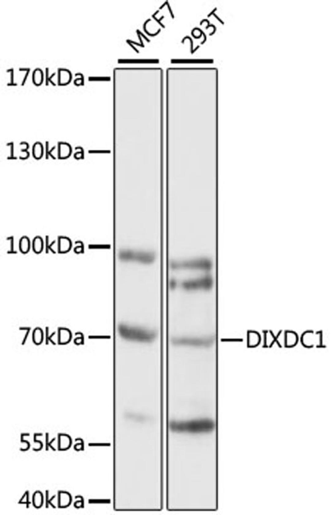 Western blot - DIXDC1 antibody (A15542)