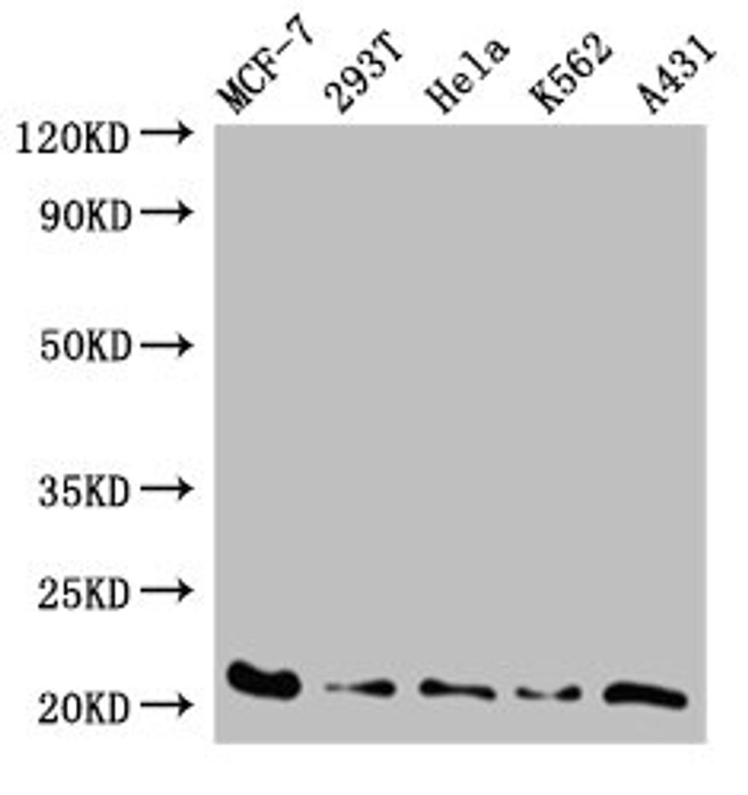 Western Blot. Positive WB detected in: MCF-7 whole cell lysate, 293T whole cell lysate, Hela whole cell lysate, K562 whole cell lysate, A431 whole cell lysate. All lanes: AK6 antibody at 0.59ug/ml. Secondary. Goat polyclonal to rabbit IgG at 1/50000 dilution. Predicted band size: 21, 20 kDa. Observed band size: 21 kDa. 