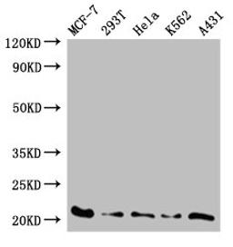Western Blot. Positive WB detected in: MCF-7 whole cell lysate, 293T whole cell lysate, Hela whole cell lysate, K562 whole cell lysate, A431 whole cell lysate. All lanes: AK6 antibody at 0.59ug/ml. Secondary. Goat polyclonal to rabbit IgG at 1/50000 dilution. Predicted band size: 21, 20 kDa. Observed band size: 21 kDa. 